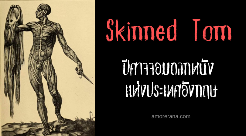 Skinned Tom ปีศาจจอมถลกหนัง แห่งประเทศอังกฤษ