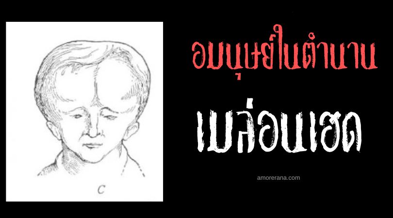 เมล่อนเฮด (Melon Head) อมนุษย์หัวแตงโม ประเทศสหรัฐอเมริกา